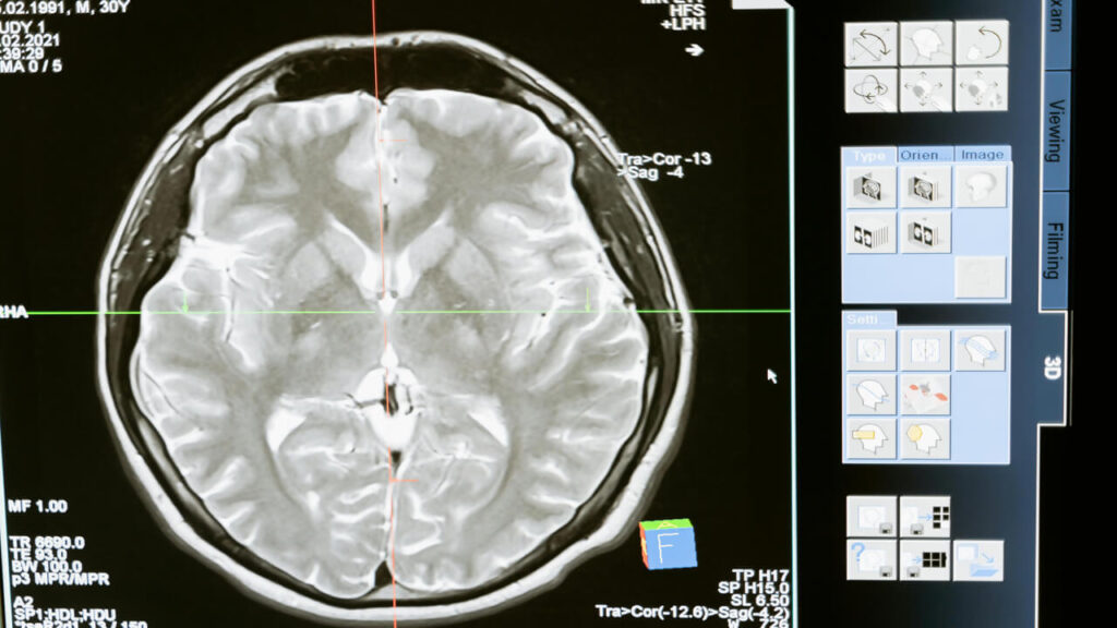 MRI Report